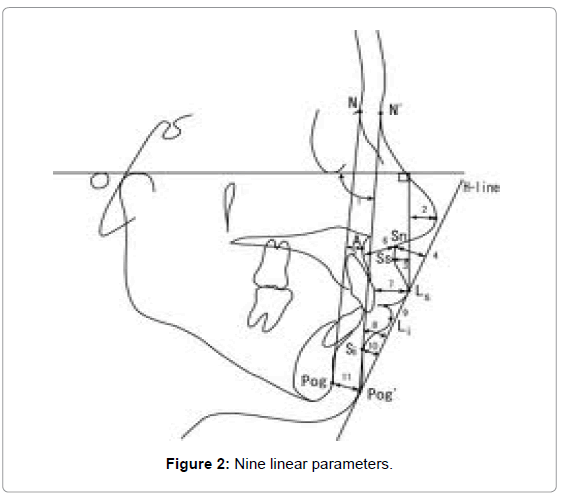 Forensic-research-nine-linear-parameters