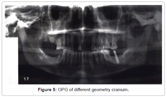 Exposure Standards for Digital and Analogue Dry Skull ...