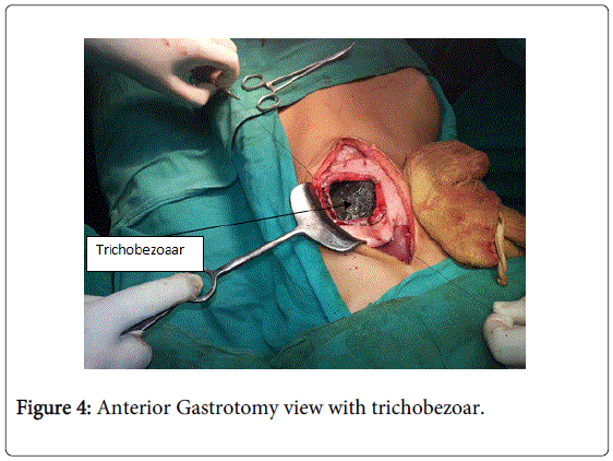 gastrointestinal-digestive-Anterior-Gastrotomy-view