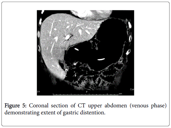 gastrointestinal-digestive-CT-upper-abdomen