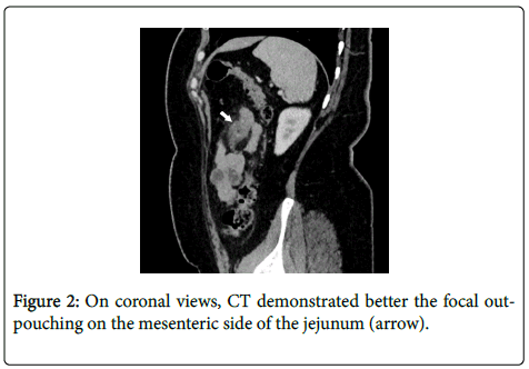 gastrointestinal-digestive-On-coronal-views