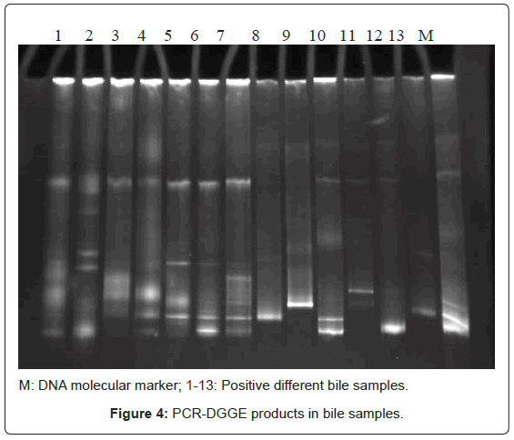 gastrointestinal-digestive-PCR-DGGE-products