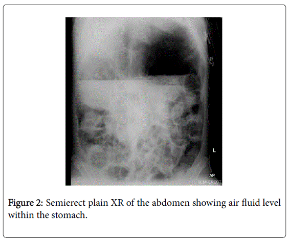 gastrointestinal-digestive-Semierect-plain-XR