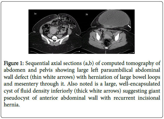 gastrointestinal-digestive-Sequential-axial-sections