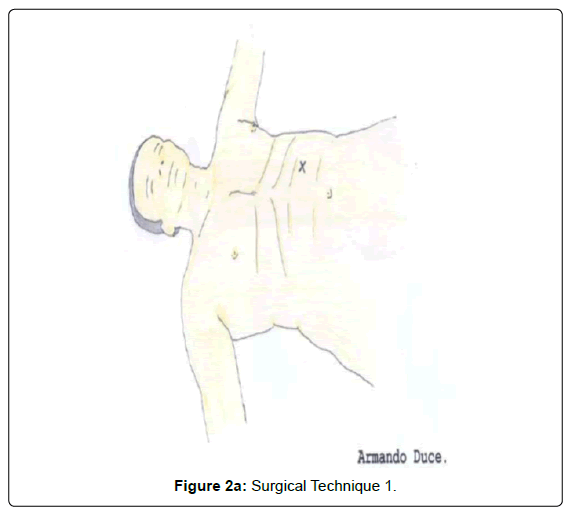 gastrointestinal-digestive-Surgical-Technique