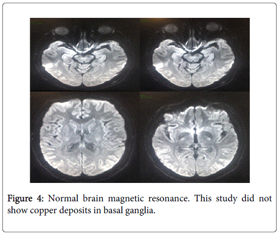 gastrointestinal-digestive-brain-magnetic-resonance