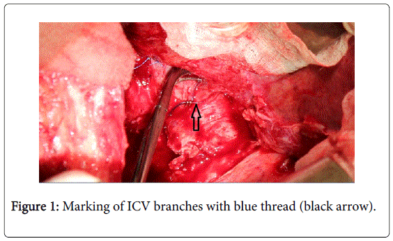 gastrointestinal-digestive-branches-blue-thread