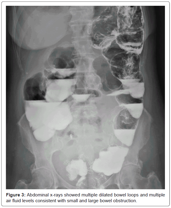 gastrointestinal-digestive-fluid-levels-consistent