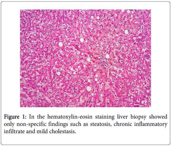 gastrointestinal-digestive-hematoxylin-eosin-staining