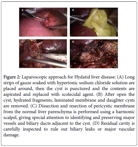 gastrointestinal-digestive-hypertonic-sodium