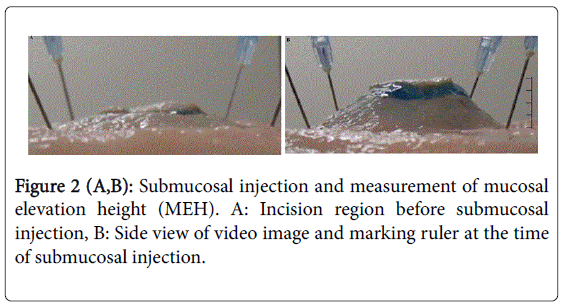 gastrointestinal-digestive-image-marking-ruler