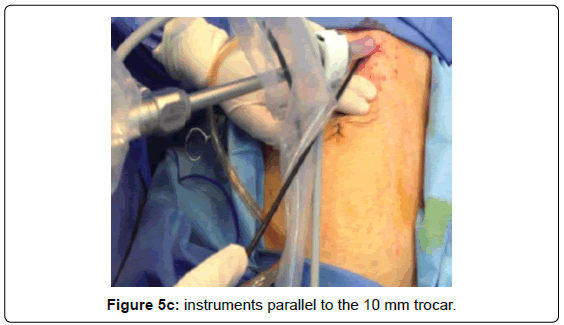 gastrointestinal-digestive-instruments-parallel