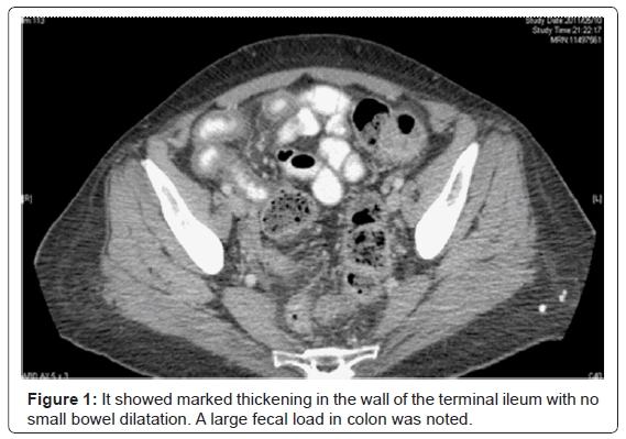 gastrointestinal-digestive-large-fecal-load