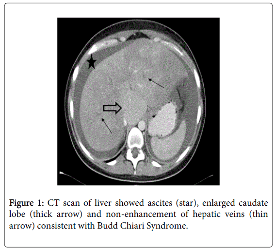 gastrointestinal-digestive-non-enhancement