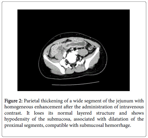 gastrointestinal-digestive-normal-layered