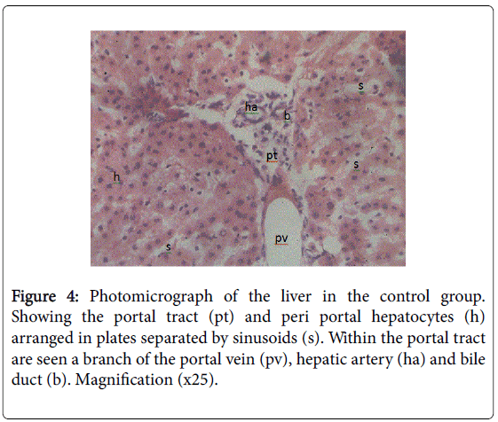 gastrointestinal-digestive-plates-separated-sinusoids