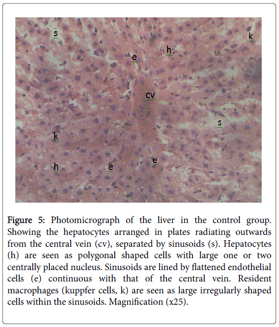 gastrointestinal-digestive-separated-sinusoids