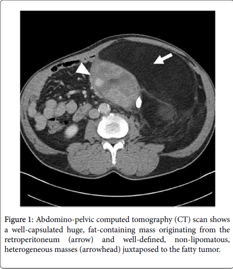 gastrointestinal-digestive-system-Abdomino-pelvic