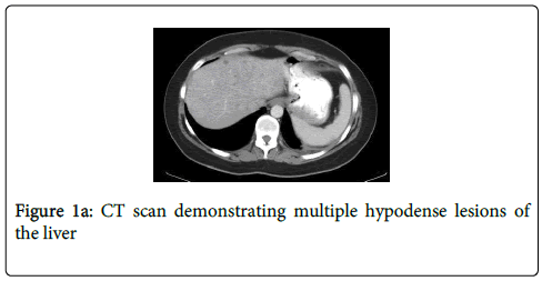 gastrointestinal-digestive-system-CT-scan