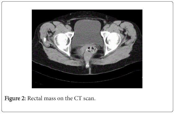 gastrointestinal-digestive-system-CT-scan