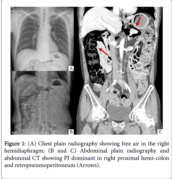 gastrointestinal-digestive-system-Chest-plain