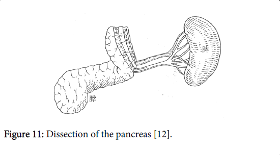 gastrointestinal-digestive-system-Dissection-pancreas