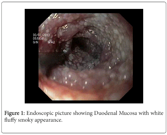 gastrointestinal-digestive-system-Duodenal-Mucosa