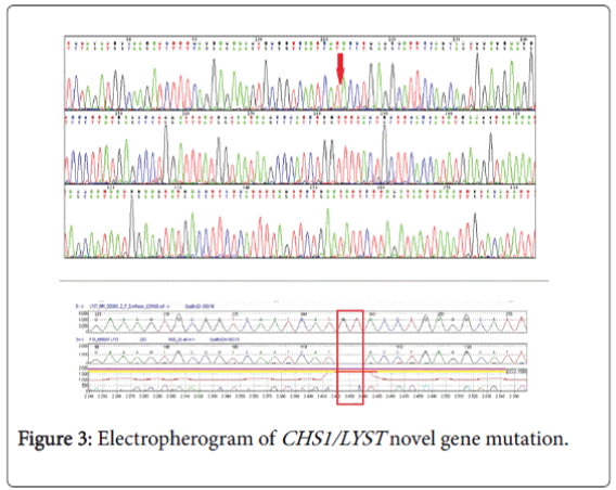 gastrointestinal-digestive-system-Electropherogram-CHS1-LYST