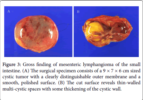 gastrointestinal-digestive-system-Gross-finding