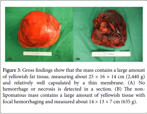 gastrointestinal-digestive-system-Gross-findings