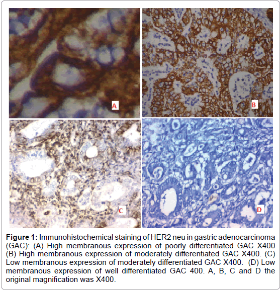 gastrointestinal-digestive-system-High-membranous