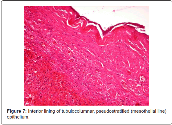 gastrointestinal-digestive-system-Interior-lining