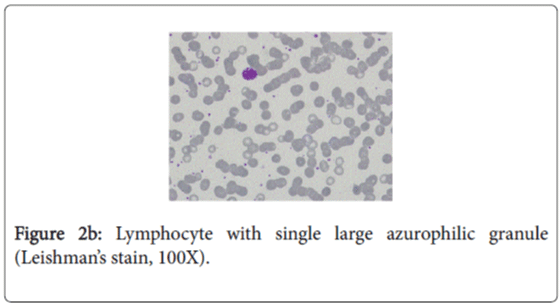 gastrointestinal-digestive-system-Lymphocyte-azurophilic-granule