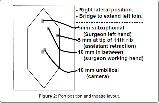 gastrointestinal-digestive-system-Port-position