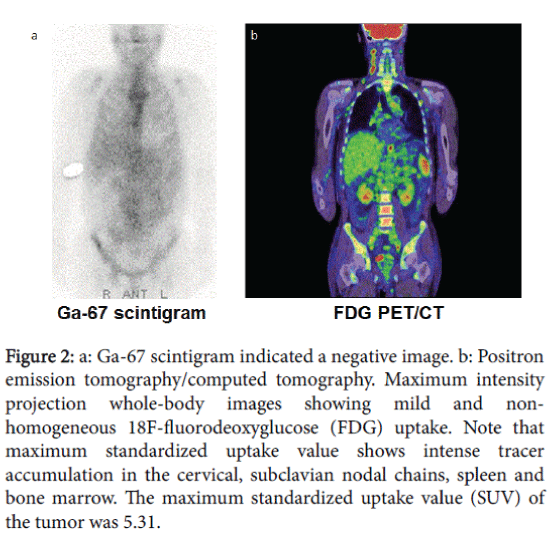 gastrointestinal-digestive-system-Positron-emission