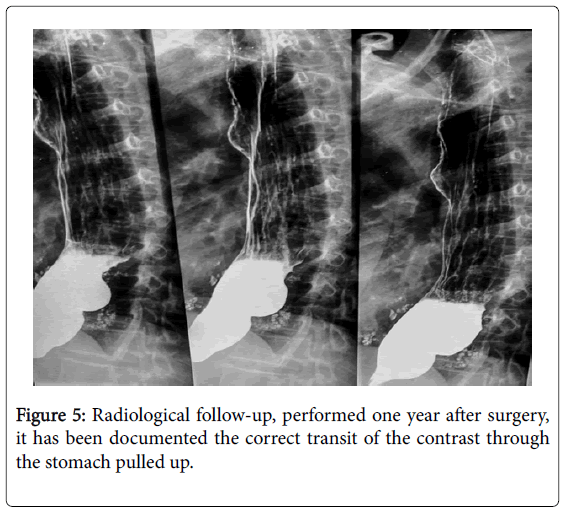 gastrointestinal-digestive-system-Radiological-follow-up