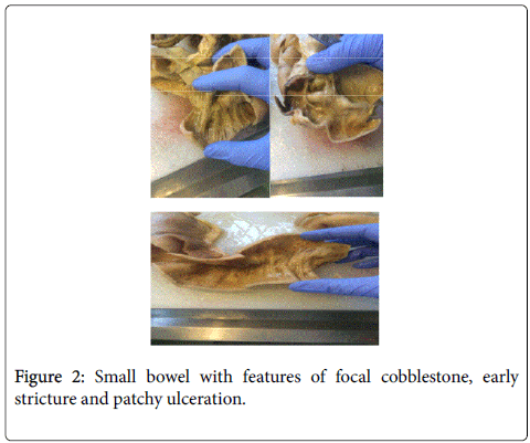 gastrointestinal-digestive-system-Small-bowel