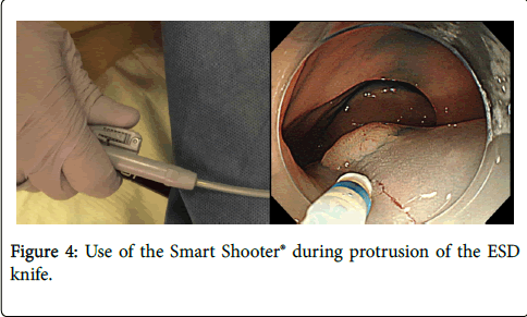 gastrointestinal-digestive-system-Smart-Shooter