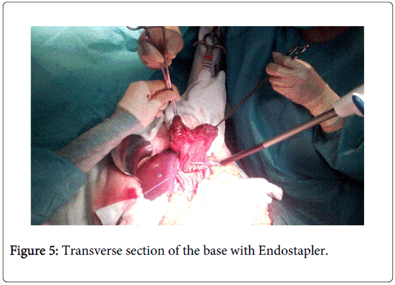 gastrointestinal-digestive-system-Transverse-section