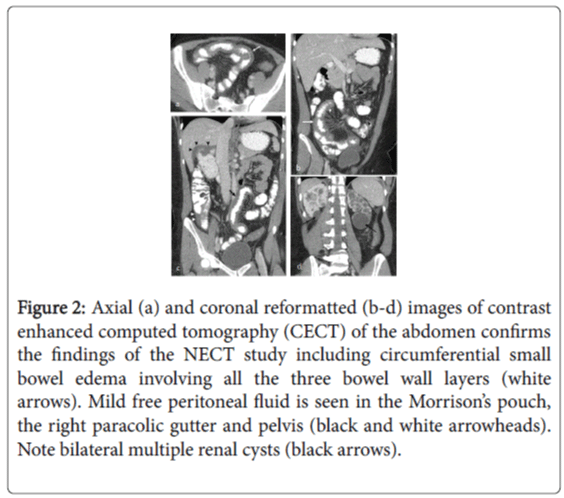 gastrointestinal-digestive-system-abdomen-confirms-circumferential