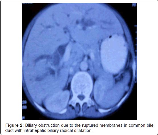 gastrointestinal-digestive-system-biliary-radical