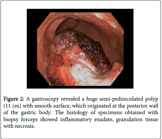 gastrointestinal-digestive-system-biopsy-forceps