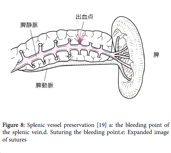 gastrointestinal-digestive-system-bleeding-point