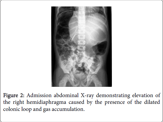 gastrointestinal-digestive-system-colonic-loop