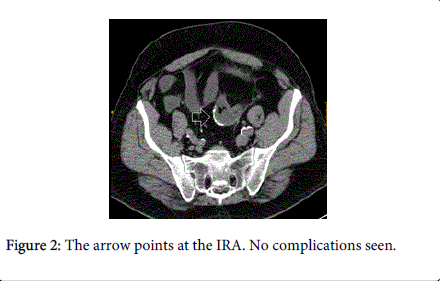 gastrointestinal-digestive-system-complications-seen