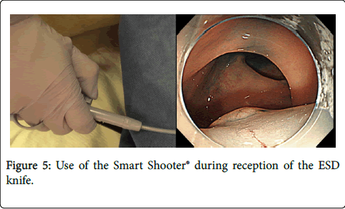 gastrointestinal-digestive-system-during-reception