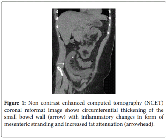 gastrointestinal-digestive-system-enhanced-computed-tomography