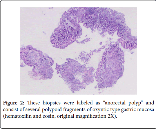 gastrointestinal-digestive-system-fragments