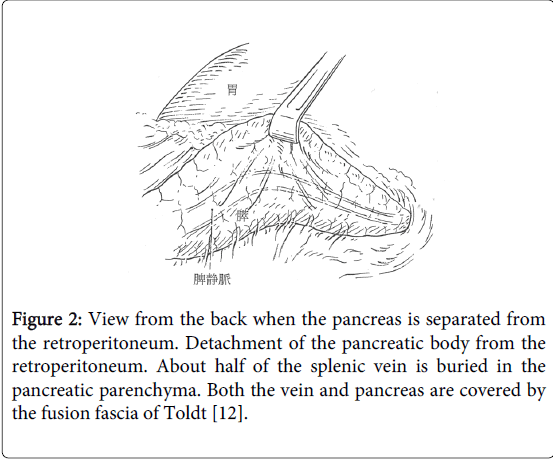 gastrointestinal-digestive-system-fusion-fascia