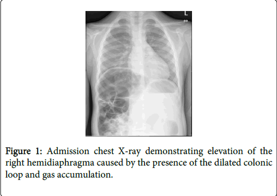 gastrointestinal-digestive-system-gas-accumulation